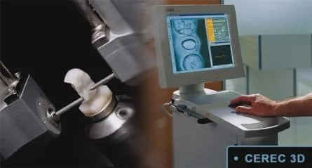 CEREC 3D